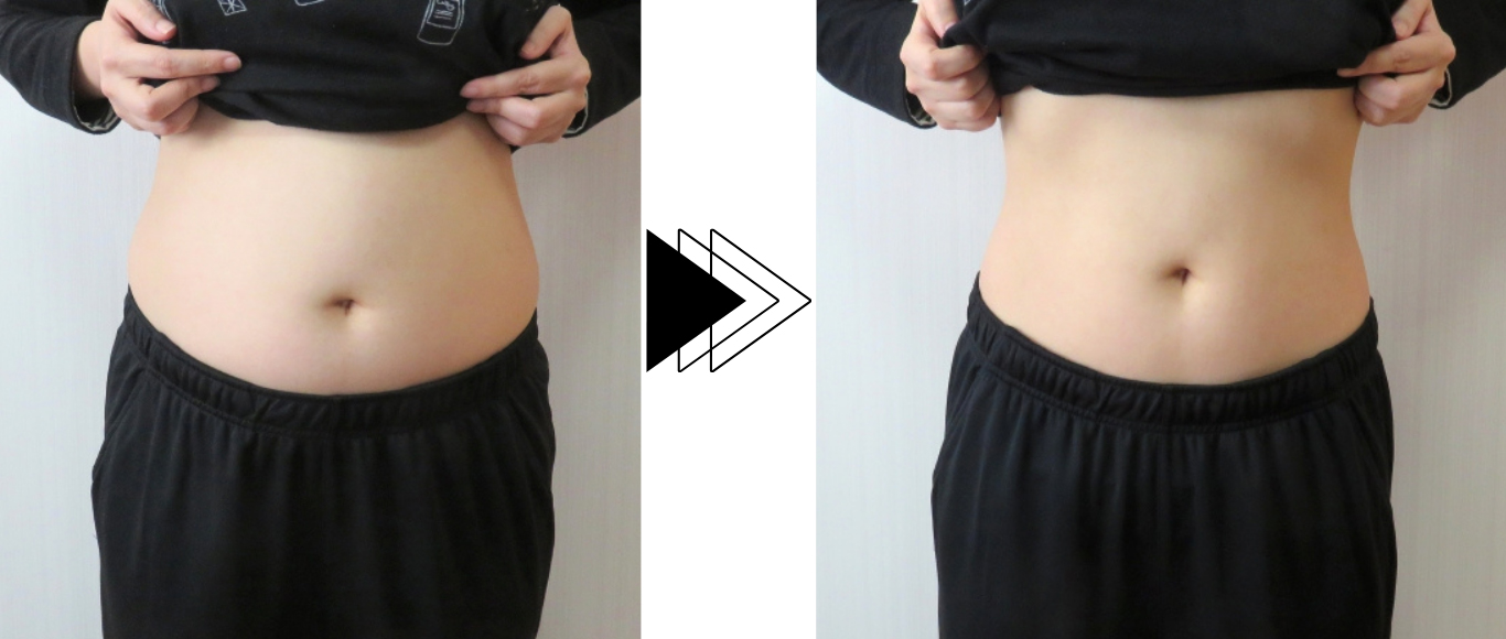 ビフォーアフター